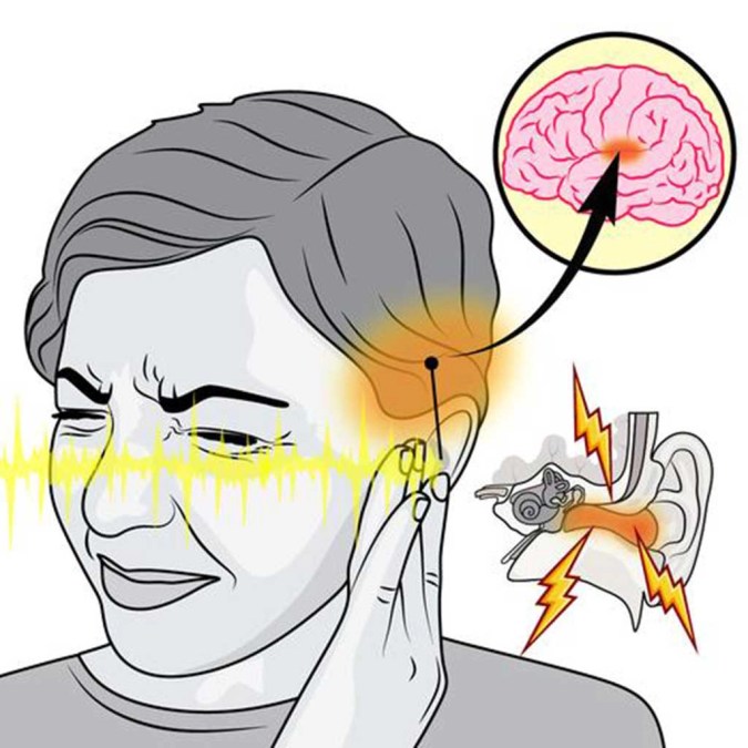 Understanding Traumatic Event Tinnitus in Maui HI